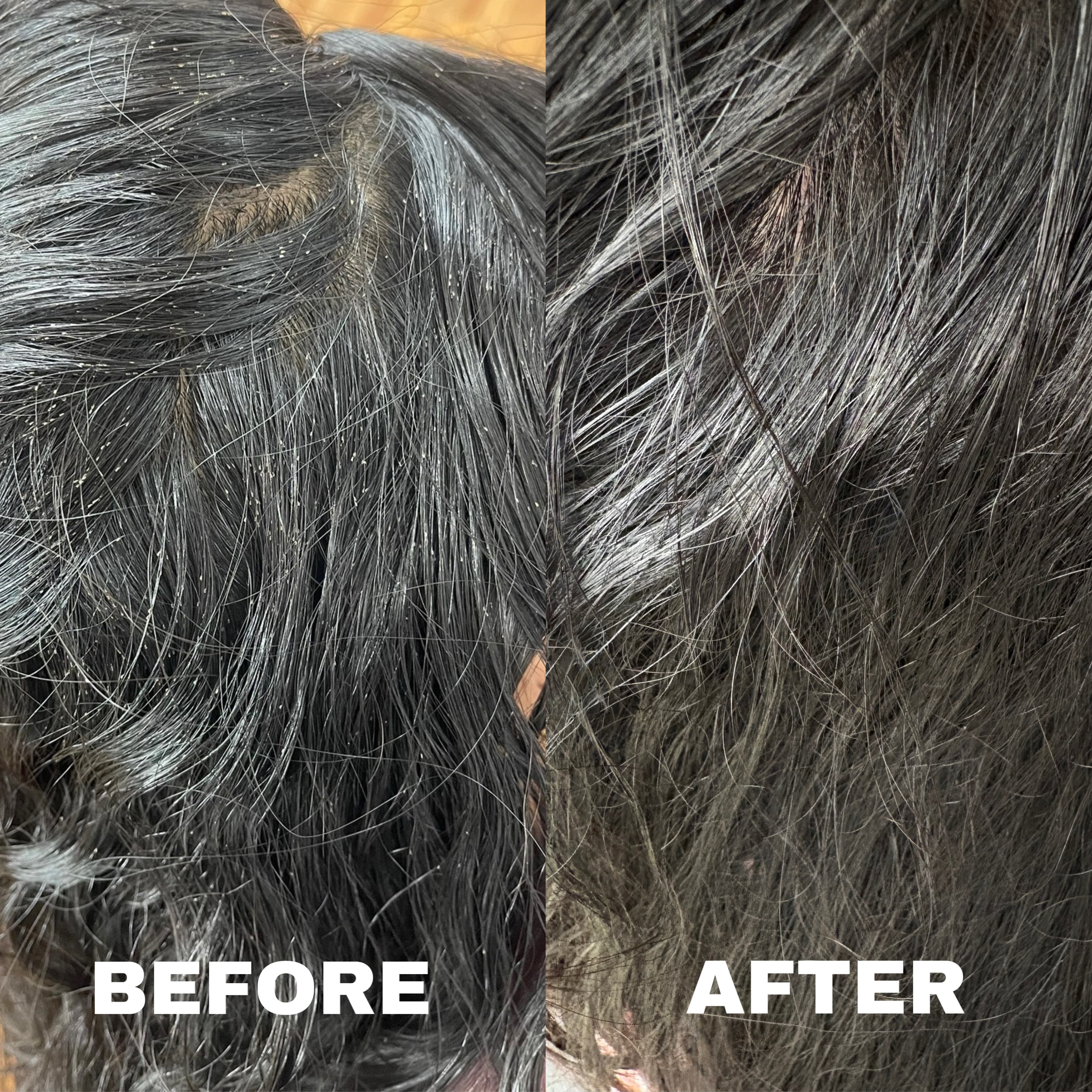 Before and after lice removal result