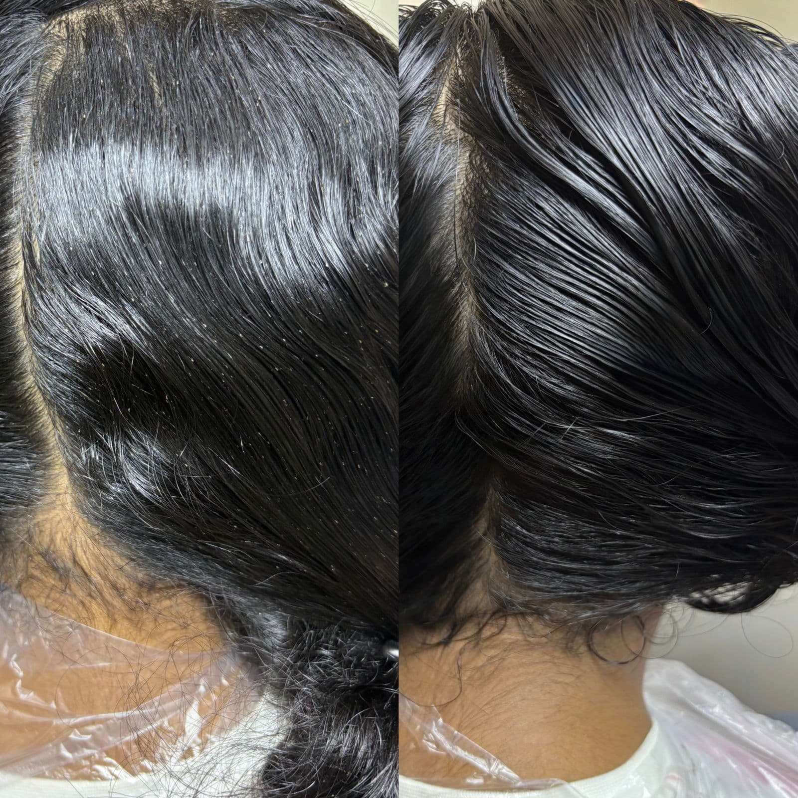 Before and after lice removal result