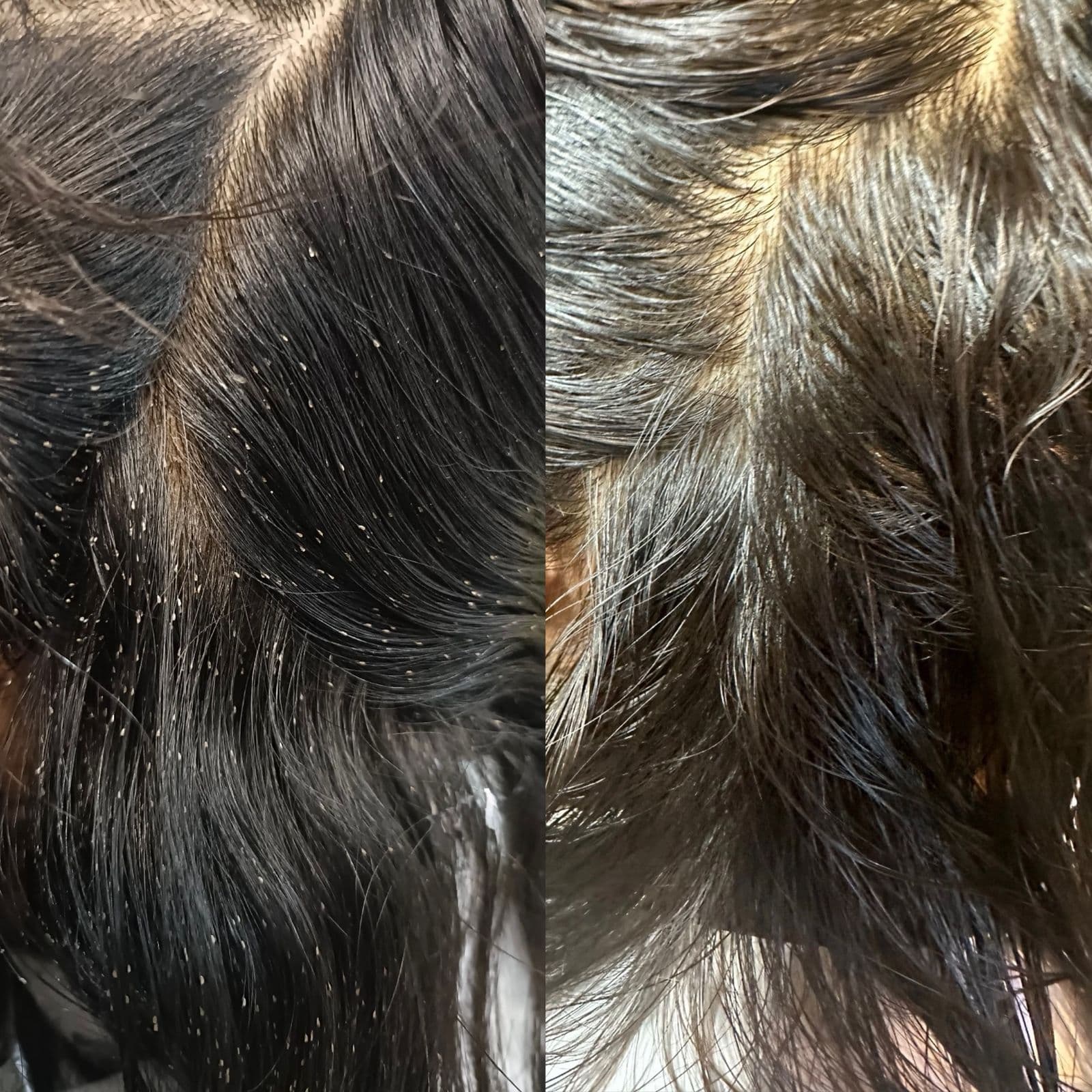 Before and after lice removal result