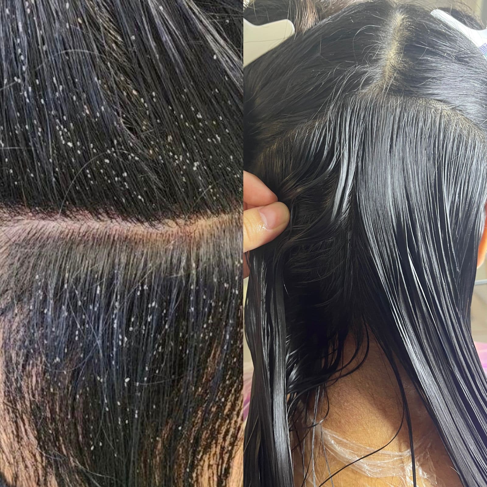 Before and after lice removal result