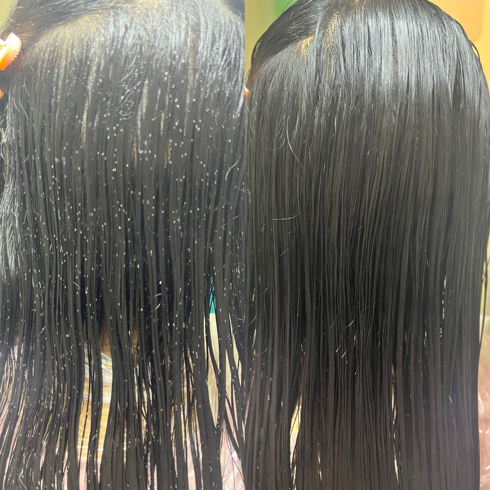 Before and after lice removal result